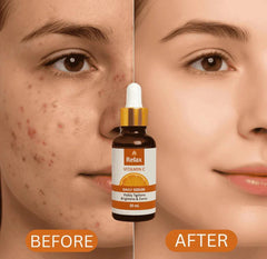 Relax Vitamin C Daily Face Serum